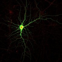 Fluorescent neuron viewed by confocal microscopy